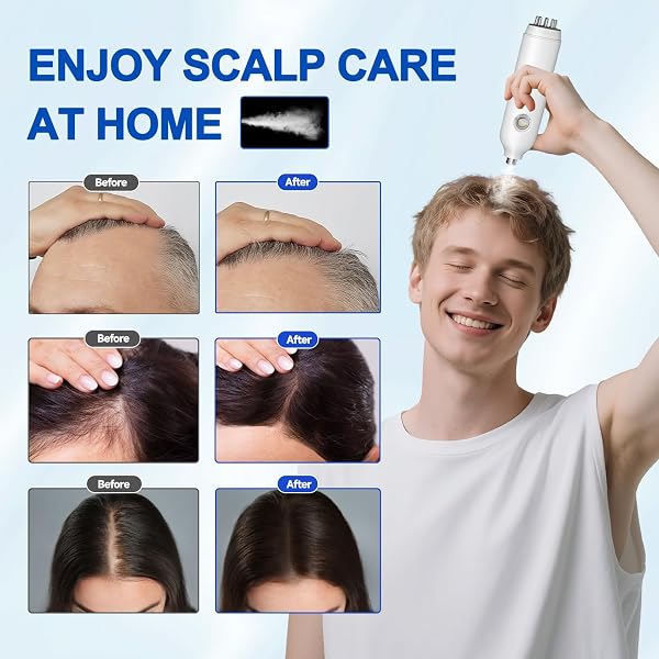 Morfone New Upgraded 3-in-1 Hair Oil Applicator, Red Light Therapy with Nano Mist Sprayer, Electric Scalp Massager Hair Growth,4 Customizable Massage Modes for Men & Women Homeuse